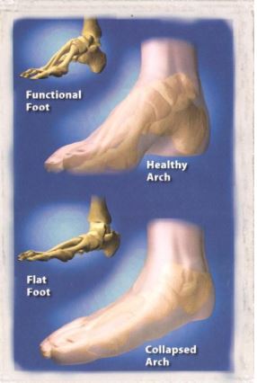 Orthotics | Heritage Health Services in Centennial, CO